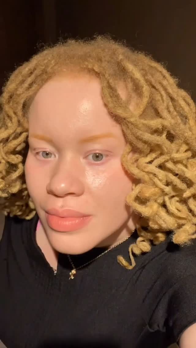 #repost of @lolosland_
When I was in school one of the #1 things I’d get bullied for was my nystagmus.
“An involuntary eye movement which may cause the eye to rapidly move from side to side“
As I continue to grow into my confidence my eyes have become one of my favorite features about myself.
Everything that I have … Praise the Lord 🤍
#lolosland #blessed #beautiful black blonde woman albinism