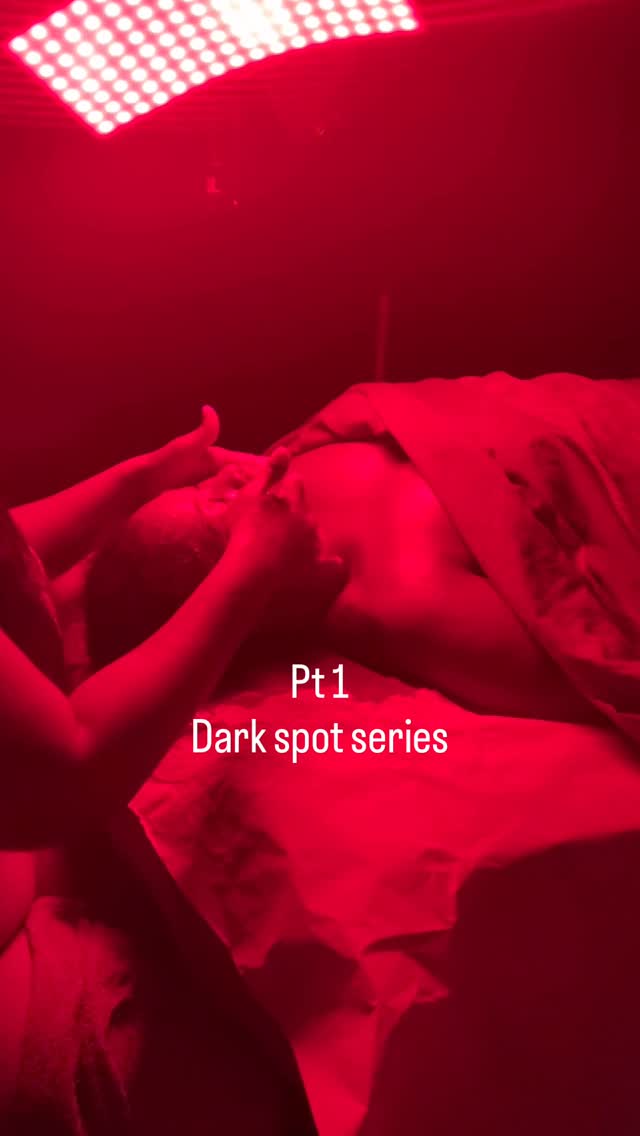 Watch this video sound on to learn more about how we treat hyperpigmentation at kemskin in our Dark spot correction series. #kemskin #darkspots #oxfordvalleymall #hyperpigmentationtreatment #facials