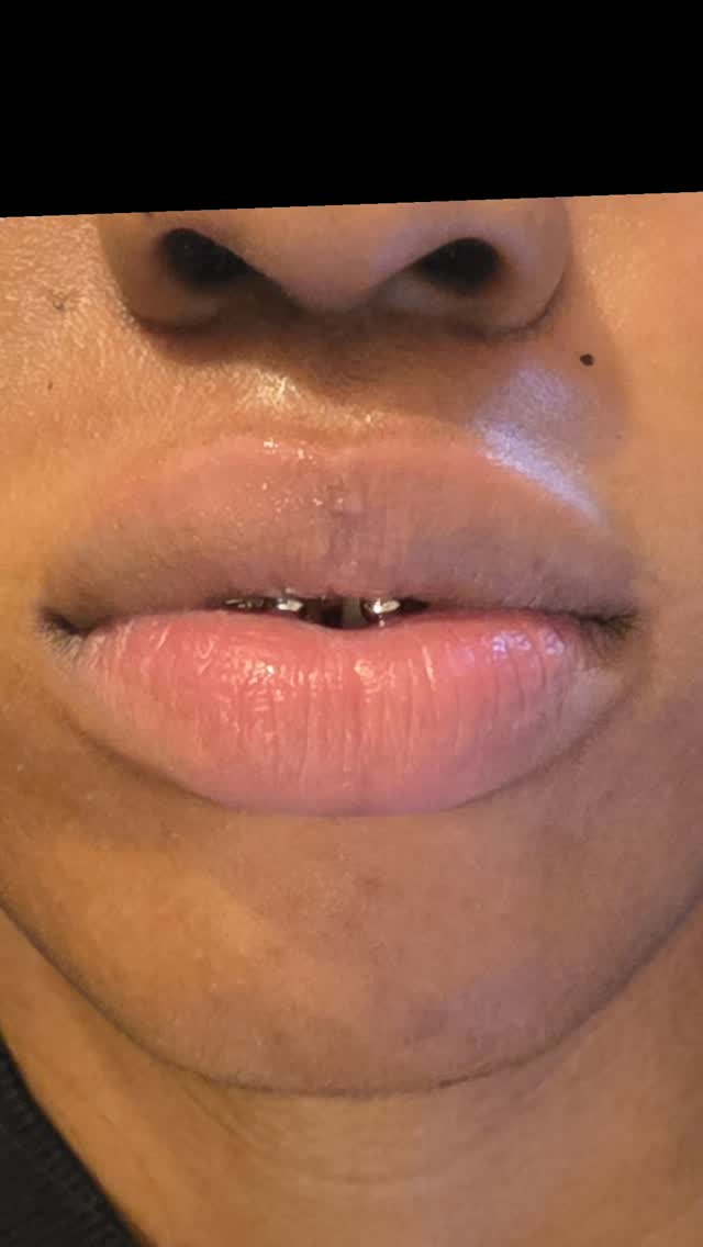 0.5ml glowup
#ChingfordSalon