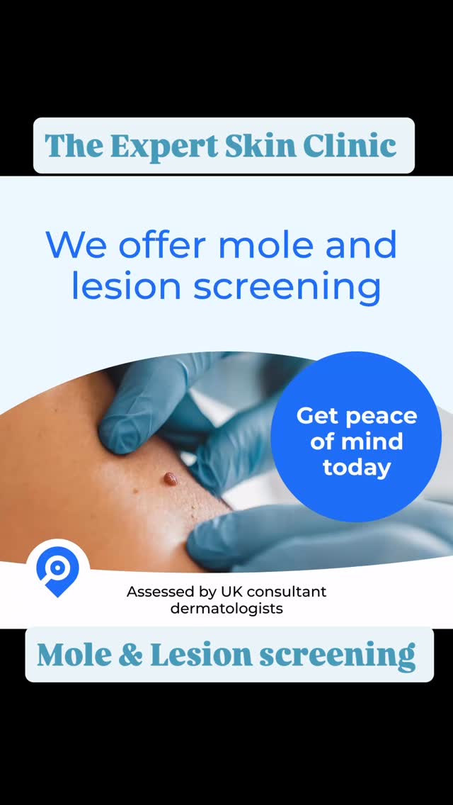 That thing you’ve noticed on your skin, It’s taking up more headspace than you think.
A mole that looks different. A patch that won’t heal. Something new that just doesn’t feel quite right you carry on with life. But it’s there in the background.
�Pulling your focus. Distracting you. I see this all the time, these things don’t just go away by ignoring them. These processes can take time.�So starting early matters.
Because one of two things happens:
You get reassurance and that mental space back instantly or you get important information early, which means you can act quickly.
�When it comes to skin cancer, early action can be life-saving. At The Expert Skin Clinic, I work in partnership with leading UK skin cancer consultants.�We take clinical images and send them for review with answers usually within a few hours to 48 hours.
If you’re local, you can book in with me.�If you’re not, please find a clinic or pharmacy near you that works with Map My Mole, it’s an incredible service. Don’t ignore it. Start the process. Get clarity.
#skincareawareness #skinhealth #molecheck #skincheck #earlydetection skincancerawareness skinclinic confidenceinyourskin