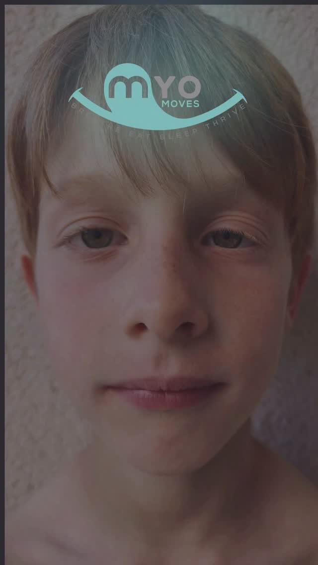 Your child’s face might be giving you clues about their breathing and sleep. And most parents are never taught what to look for.
Things like dark circles, open-mouth posture, or restless sleep are often brushed off as “normal.” But many times they’re early signs that a child may be struggling to breathe well — especially at night.
When the airway isn’t functioning the way it should, you might notice:
• Snoring or restless sleep
• Mouth breathing
• Dark circles under the eyes
• Daytime fatigue or hyperactivity
• Frequent colds or sinus issues
• Bedwetting past age 5
These signs aren’t something to ignore or just “wait and see.”
At Myo Moves, we focus on supporting healthy breathing patterns and facial development early — when it matters most.
Because when kids breathe better, they sleep better. And everything else gets easier.
💬 Comment GUIDANCE and we’ll help you figure out the next step.