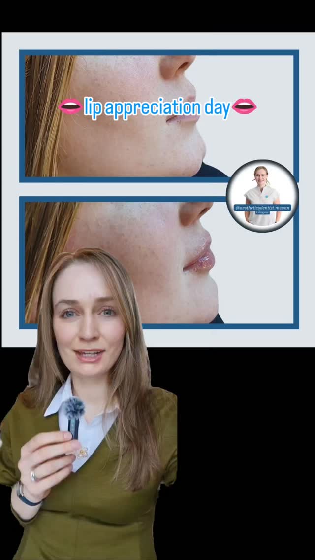 👄heard on the radio 📻 today that it's national lip appreciation day so let's have a blether about lip enhancement..
You're absolutely gorgeous the way you are! If li enhancement will boost your confidence then give me a shout.
Megan x