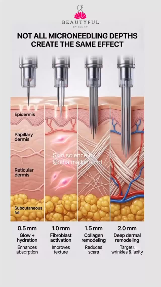 Not all microneedling is the same… depth matters ✨
And the best part… it’s not just for one age group 👇
💛 In your 20s/30s – helps keep skin fresh, smooth & glowing
💛 In your 30s/40s – supports collagen (your skin’s natural bounce!)
💛 40+ – helps soften lines, improve texture & bring life back to the skin
Think of it as a workout for your skin – helping it stay strong, healthy and radiant at any stage ✨
DM me if you’re not sure what depth is right for you 💌 we can get a consultation booked in 🫶