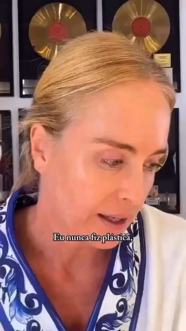 Nem tudo precisa de cirurgia.
O bom gerenciamento do envelhecimento passa, muitas vezes, por uma combinação inteligente de cuidados: protetor solar diário, skincare adequado, tecnologias dermatológicas e injetáveis bem indicados.
Quando esses recursos são usados de forma estratégica e no momento certo, é possível preservar a qualidade da pele, estimular colágeno e manter a harmonia do rosto ao longo do tempo sem mudanças artificiais.
Mais do que corrigir, a dermatologia hoje permite planejar o envelhecimento com equilíbrio e naturalidade.
Dr Emmanuel França
Dermatologista
CRM 5999
RQE 636
📍Skin Prime - Riomar Trade Center - Torre 3 - Sala 1905
☎️ (81) 3036-4040