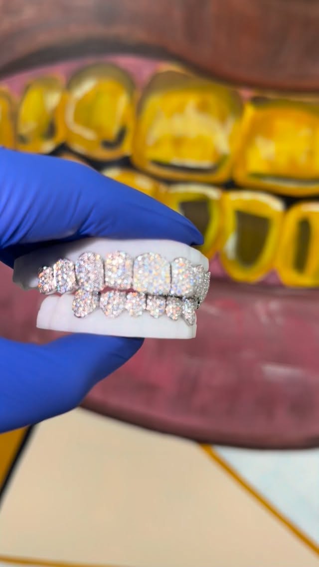 Starts at $250 per tooth #labdiamonds
