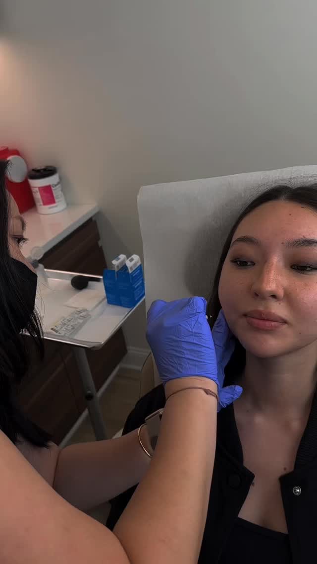 the question everyone is asking… does masseter tox cause jowls?
schedule a free consultation with our Nurse Practitioner or book masseter tox under Wrinkle Relaxers at lingspa.com #masseter #nyc #medspa #lingspa