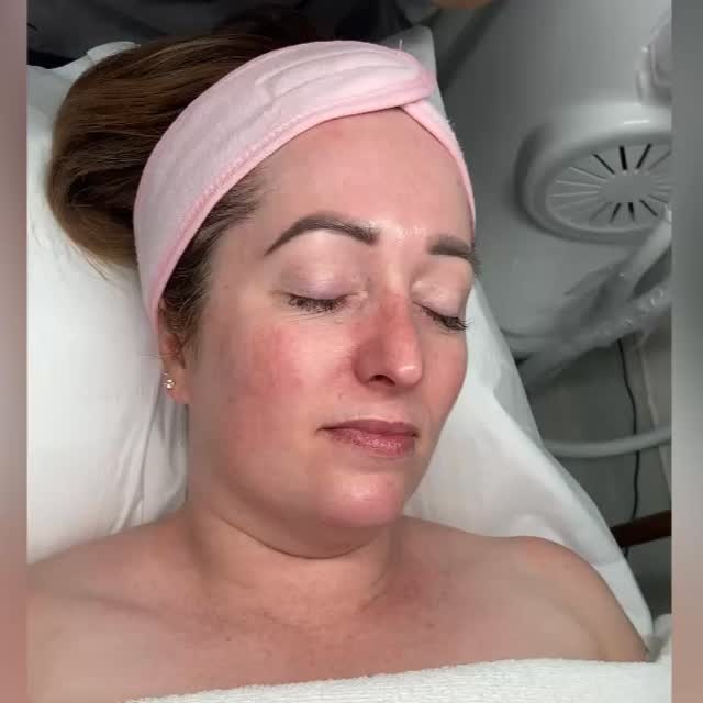 Million Dollar LimyphFlo, face lifting and contouring
Keys benefits:
. Boost circulation and lymphatic drainage.
. Reduce puffiness and facial tension, sculpts and defines facial features.
. Supports clearer, more radiant complexion.
. Improves skin elasticity and firmness.
. Enhances product absorption during the treatment.