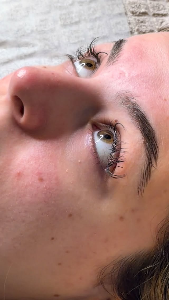 ‼️ not my work removed here ‼️
Before starting a new set with my own work, I first needed to remove the old lashes applied by another lash artist.
They were stuck together and honestly not the best work I’ve seen.
Anyway, this is the technique I use to remove lashes — simple and fast. ✨