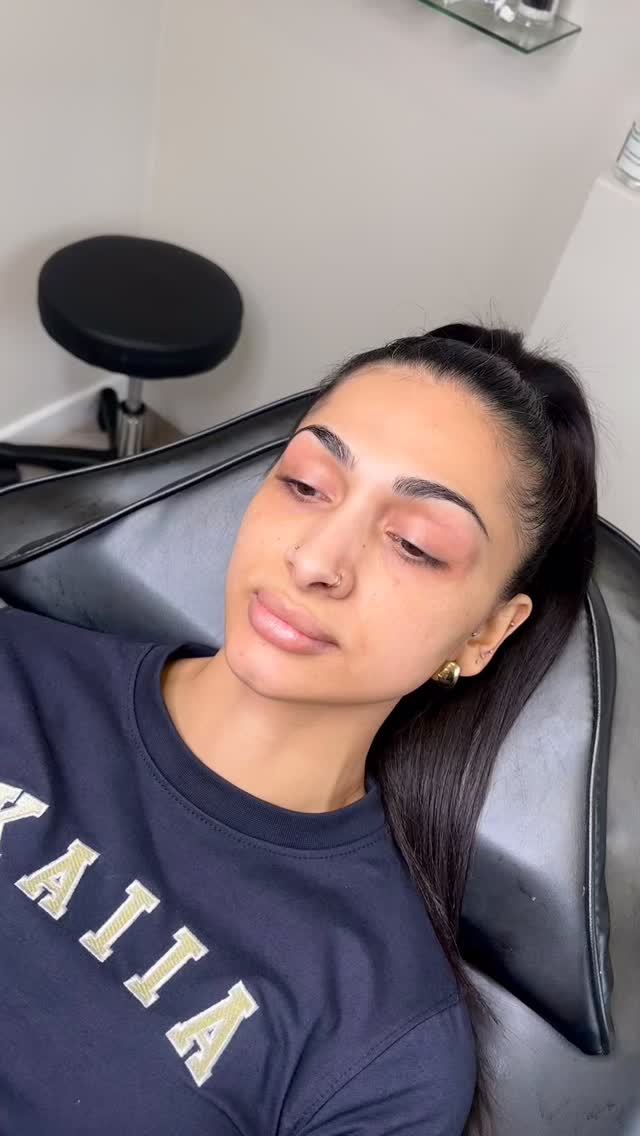 0.5ML LIP ENHANCEMENT 👄
A subtle refresh for our gorgeous client who hadn’t had her lips done since 2024… and look how well they’ve held ✨
This time we used Teosyal Kiss to restore hydration, shape, and that soft volume!
Our patient feedback:
“By far the best, always does an amazing job and I always leave feeling my best self. I would highly recommend! Thank you” 🤍
To book an appointment, please visit www.ceteaesthetics.co.uk
ALMOST FULLY BOOKED FOR APRIL
#scunthorpeaesthetics #lipfiller #lincolnshireaesthetics #scunthorpe #lipfillerscunthorpe