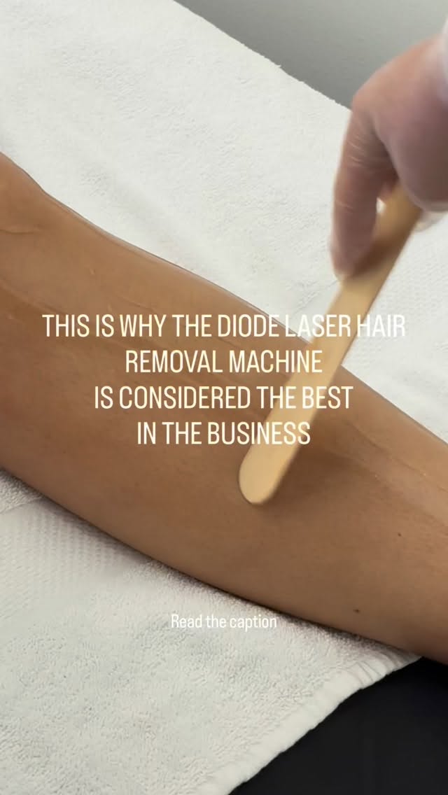 POV: you finally stop wasting money on shaving, waxing… and EVERYTHING changes 🔥
Here’s why we chose diode laser hair removal in our salon (and why you’ll never go back once you try it):
✨ It actually WORKS long-term
Diode technology targets the hair follicle at a deeper level = real reduction, not just temporary smoothness.
✨ Ice cooling head = way more comfortable ❄️
Constant cooling keeps the skin cold during treatment… meaning less heat, less discomfort, and a much more relaxing experience.
✨ You can have fake tan on 🙌
No stressing about scrubbing it off before your appointment — this technology allows more flexibility with tanned skin.
✨ Safe for more skin types
Unlike older lasers, diode is designed to treat a wider range of skin tones safely and effectively.
✨ Faster sessions
Larger treatment heads = quicker appointments (because who has time to lay there all day?)
✨ Consistent results
With the right plan, expect smoother skin, less regrowth, and finer hair over time.
We don’t cut corners when it comes to your skin — we invest in technology that gives you REAL results.
So if you’re still shaving every 2 days… this is your sign 👀