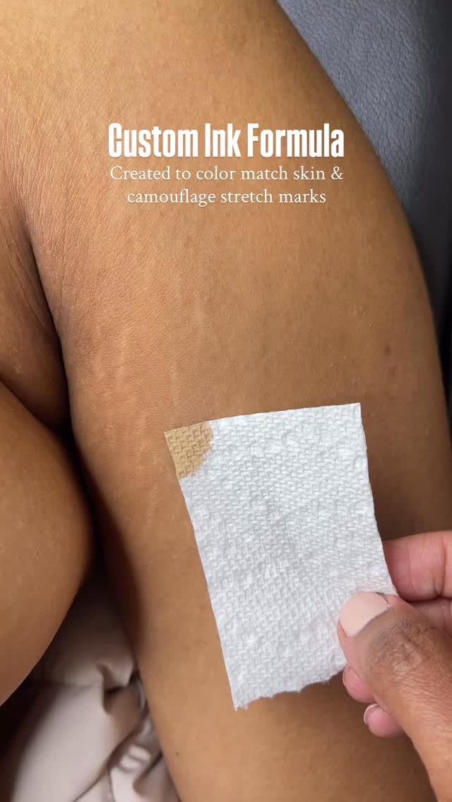 Selecting the perfect ink for Medical Tattooing involves custom-blending pigments to match the client’s unique undertones rather than using a single shade to ensure natural-looking results blend seamlessly.
Key considerations include using specialized, high-quality pigments, understanding, and anticipating how colors heal.
Book a consultation or your appointment today @beatandblade!
BEATANDBLADE.COM
#skincare #fashion #ootd #medicaltattoo #stretchmarkremoval