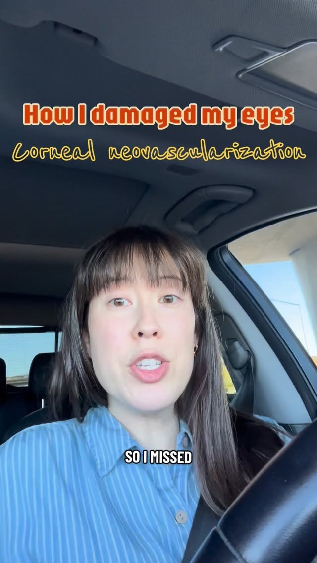 #worldoptometryday #latetotheparty 🌎🥸
Don’t abuse your contact lenses folks!