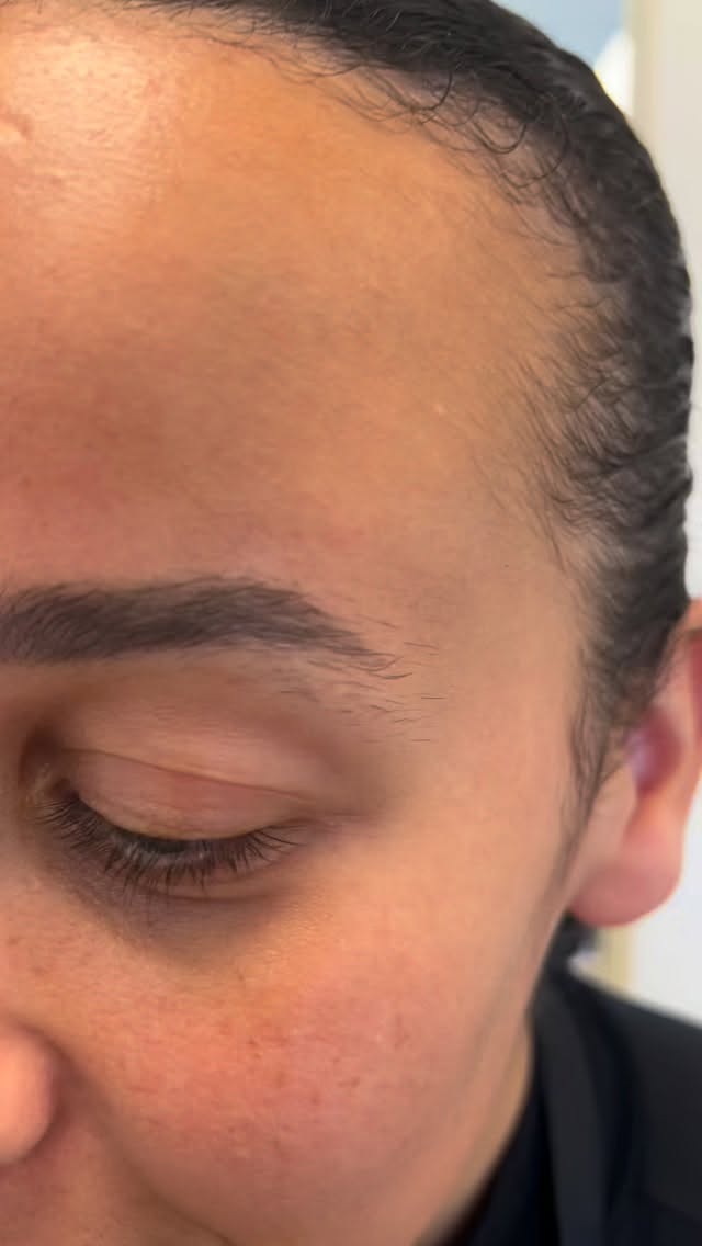 Wist je dat…
Je bij Palma V niet alleen terecht kunt voor je knip of kleurbehandeling, maar ook voor een mooie brow treatment?
Tijdens het harsen van je wenkbrauwen worden ongewenste haartjes zorgvuldig verwijderd en brengen we jouw wenkbrauwen perfect in vorm. In combinatie met het verven zorgen we voor een vollere, strakkere en sprekende look die helemaal past bij jouw gezicht.
Ideaal als extra behandeling tijdens je afspraak
Snel, effectief en direct zichtbaar resultaat
Boek jouw Brow treatment eenvoudig bij als extra bij je knip of kleurbeurt en geef je look nét dat beetje extra!
#salonpalmav #palmav #browtreatment