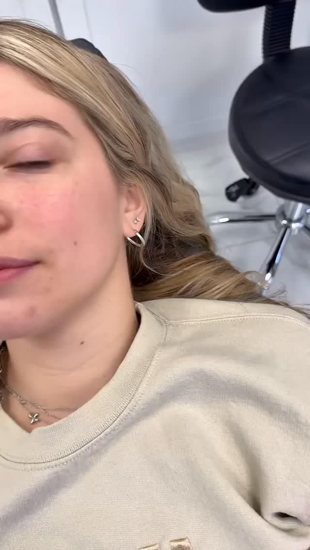 💋 Subtle. Balanced. Beautiful.
Lip fillers are all about enhancing what you already have — adding volume, defining shape, and creating that smooth, hydrated look without overdoing it.
Whether you want a soft natural boost or a little extra glam, the goal is always the same: confidence that looks effortless. ✨
Ready for your glow-up?
Call or text today to book your appointment!
☎️ 239-448-3383
📩 chris.jewell@jewellmedicalspa.com
🌐 www.jewellmedicalspa.com | www.mrinjectable.com
📍 1044 Castello Drive, Ste 213 Naples Florida 34103
💳 We Accept Care Credit!
*
*
*
#lipfiller #lipfillers #lipaugmentation #lipplump #lipinjection #lipenhancement
#lipcontouring #restylanelips #injectables #dermalfillers #cosmeticinjectables #aesthetics #beauty #restylane #restylaneusa #naplesbeauty #naplesinjector #medspa #dolllips #lippies #bestaestheticinjectors #beforeandafter