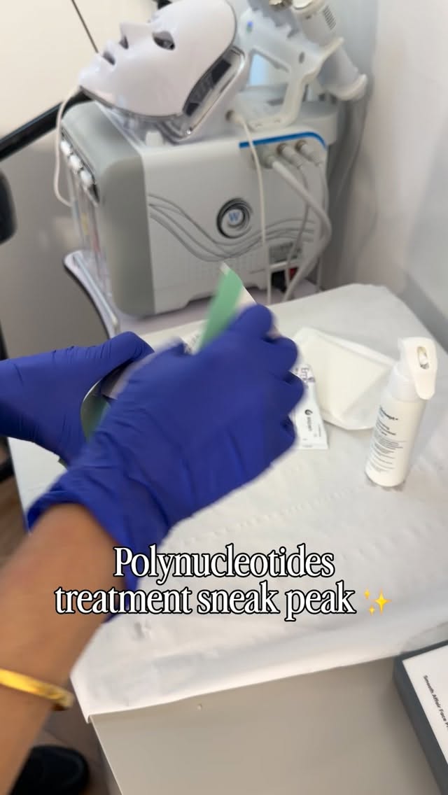 ✨ A Sneak Peek at Polynucleotides ✨
You may have seen this treatment trending… here’s what it actually does 👀
Polynucleotides are a skin regeneration treatment designed to improve skin quality from within — focusing on long-term skin health rather than instant change.
✨ What it does:
• Improves skin texture and tone
• Boosts hydration
• Supports collagen and elastin
• Strengthens the skin barrier
• Calms redness and inflammation
• Improves elasticity and firmness
💉 What to expect:
Following numbing, the treatment involves a series of small, precise injections into the skin to deliver the product where it’s needed most. The procedure is quick and well-tolerated.
⏳ Healing time:
You may experience small bumps, redness, or slight swelling for 24–72 hours. These settle naturally as the product begins to work, with results developing gradually over the following weeks.
This is a perfect treatment if you’re looking to improve your skin naturally and from the inside out ✨
📅 Book your consultation to find out if it’s right for you 💛