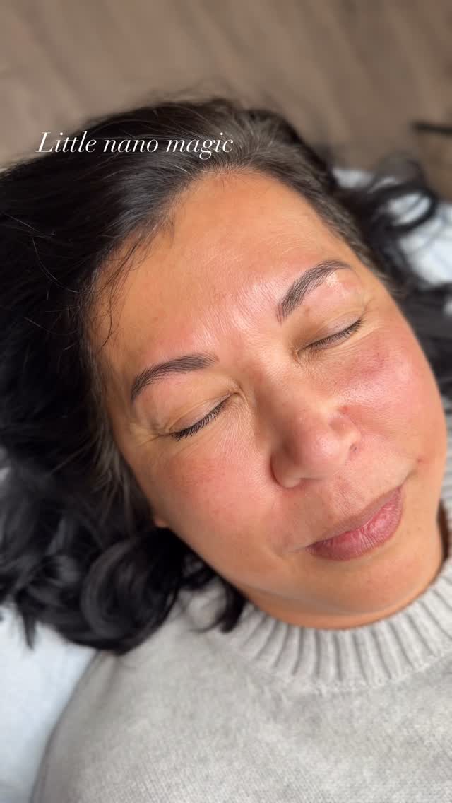 Little nap magic… and you’ll never have to worry about your brows again ✨
If you’ve been filling in your brows every morning, struggling with uneven shapes, or losing definition over time… this is your sign.
Nano brows are a form of brow tattoo designed to mimic natural hair while creating soft, balanced structure that lasts. No smudging, no daily makeup, no guesswork.
Wake up with brows that already look done 🤍
Perfect for:
• sparse or overplucked brows
• busy mornings
• anyone wanting natural, low-maintenance beauty
Serving clients looking for nano brows in Acworth, Kennesaw, Woodstock, and Marietta 📍
Save this if you’re ready to simplify your routine.
#nanobrowsatlanta #atlantabrows #acworthga #kennesawga #mariettaga