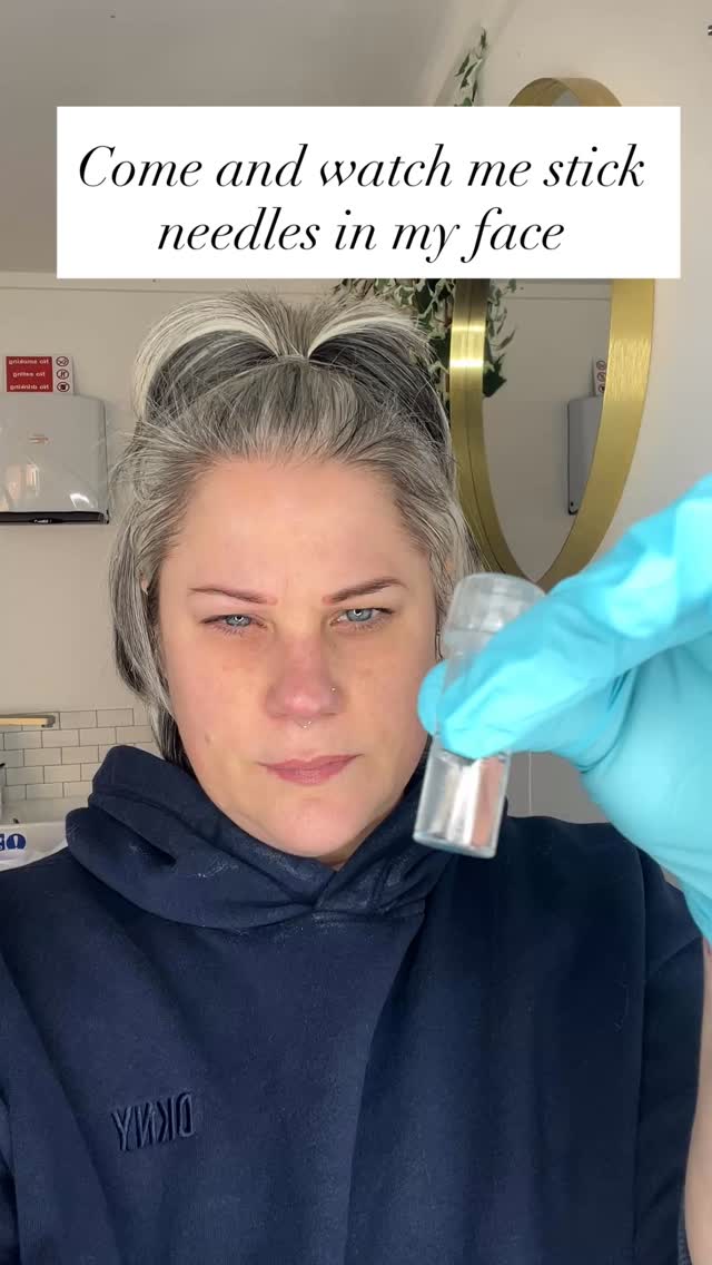 Microneedling doesn’t “thin” your skin… it actually forces it to rebuild stronger.
Those tiny needles? They create controlled micro-injuries that trigger collagen + elastin production — meaning firmer, smoother, healthier skin over time.
But here’s the part most people don’t realise:
It’s not the treatment alone that transforms your skin… it’s the healing process afterwards.
That’s why results depend on consistency, correct depth, and proper aftercare — not just one appointment.
Glowing skin isn’t instant… it’s built. ✨
#Microneedling #leightonbuzzardmums #rejuvenatedface #tiredmummy #leightonbuzzardaesthetics