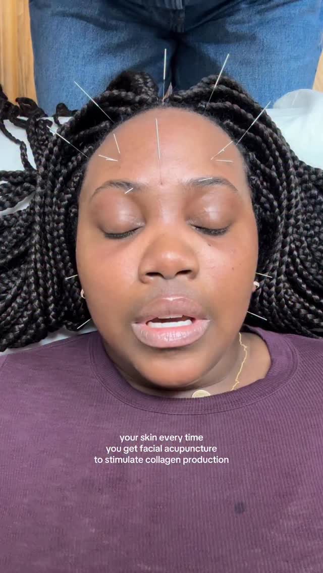 gratitude makes your skin glow 🕊️✨
#facialacupuncture #cosmeticacupuncture #chinesemedicine #acupuncture #acupuncturist