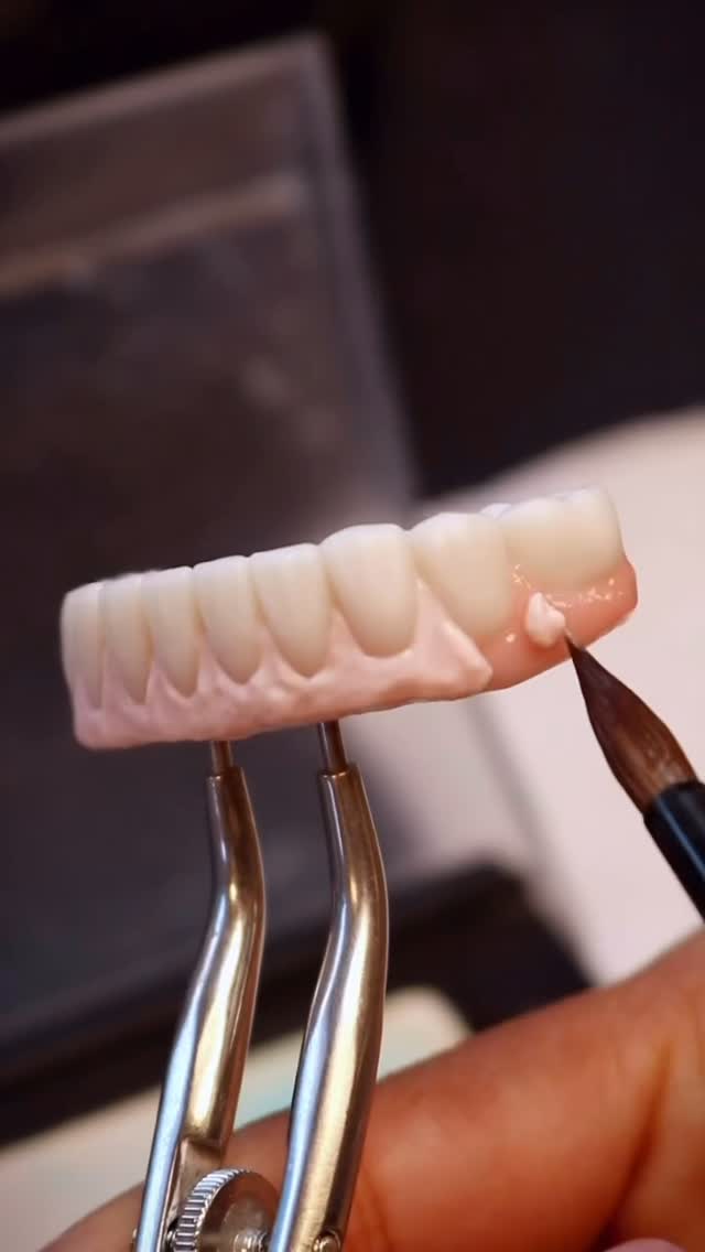 Where precision meets artistry. Layer by layer, crafted to perfection🦷✨🧬 #dentallab #dentaltech #dentaltechnician #westpalmbeach