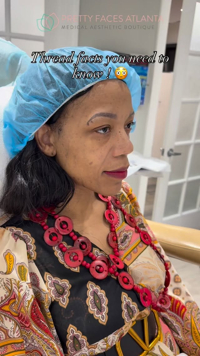 PDO Threads aren’t just about a quick lift… they’re a full collagen boost over time 😮🔥
✔️ Instant lift + long term tightening
✔️ Stimulates collagen for months after
✔️ Perfect for jawline, cheeks, and neck
✔️ Minimal downtime, back to life quick
✔️ Results can last 12 to 18 months
If you’ve been lifting your face in the mirror… this is literally the real version of that 👏🏽
Not sure if you’re a candidate? That’s what consultations are for. Let’s build a plan that fits YOU.
Book now and let’s get you snatched the right way 💉✨
#PDOThreads #ThreadLift #SkinTightening #PrettyFacesAtlanta #Snatched