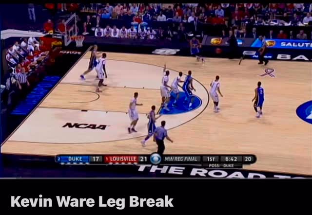 On this date in @louisvillembb history, 13 years ago today on March 31st 2013, @kevinware_official had one of the most gruesome moments in #marchmadness history.
Louisville would go on to trounce Duke in this game and go on to beat @umichbball to win the 2013 national championship.