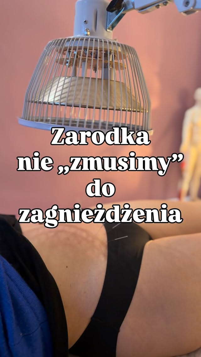 Zarodka nie „zmusimy” do zagnieżdżenia…
ale możemy stworzyć mu najlepsze możliwe warunki. 💫
Wczoraj w gabinecie… przygotowanie do transferu 🤍
To trochę jak przygotowanie gleby 🌱
Bo transfer to nie jest jeden dzień.
To efekt tego, co budujemy wcześniej.
Z perspektywy medycyny chińskiej przygotowanie zaczyna się dużo wcześniej –
najlepiej minimum 3 cykle przed transferem, żeby:
✨ wyrównać hormony
✨ poprawić krążenie krwi i Qi
✨ odżywić organizm i macicę
Bo wg TCM płodność opiera się na harmonii Nerek, Krwi i Macicy, a bez dobrej jakości Krwi i przepływu nie ma dobrego „gniazdka” dla zarodka.
👉 W cyklu transferowym działamy intensywniej:
– akupunktura od początku cyklu
– wsparcie krążenia i przygotowanie endometrium
– zioła implantacyjne (Twoje „ziołowe wsparcie zagnieżdżenia”)
👉 A w dniu transferu:
– akupunktura przed i po transferze
– wyciszenie układu nerwowego
– wsparcie przepływu do macicy
Akupunktura:
✔️ zwiększa szansę na implantację (pozytywną betę hCG) nawet o ok. 50% przy transferach mrożonych zarodków
✔️ poprawia jakość i morfologię endometrium
Jeśli czujesz, że chcesz „dołożyć igiełki szczęścia” do swojego transferu –
to właśnie tu zaczyna się Twoje przygotowanie 💫
Zaopiekuj się sobą w Bertha Holistic. 🍀