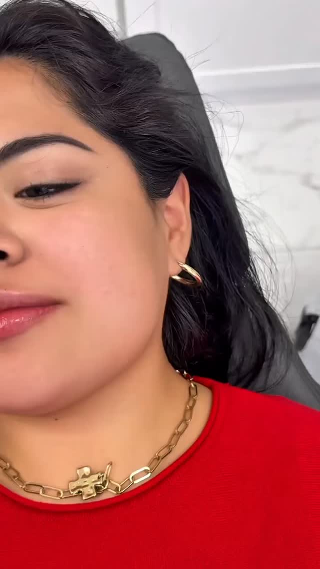 ✨ Pout perfection, one lip at a time! 💋 Whether you want subtle volume or a full-on glam look, lip fillers are the secret to that perfect shape. Are you ready to enhance your smile? 😘
Call or text today to book your appointment!
☎️ 239-448-3383
📩 chris.jewell@jewellmedicalspa.com
🌐 www.jewellmedicalspa.com | www.mrinjectable.com
📍 1044 Castello Drive, Ste 213 Naples Florida 34103
💳 We Accept Care Credit!
*
*
*
#lipfiller #lipfillers #lipaugmentation #lipplump #lipinjection #lipenhancement
#lipcontouring #restylanelips #injectables #dermalfillers #cosmeticinjectables #aesthetics #beauty #restylane #restylaneusa #naplesbeauty #naplesinjector #medspa #dolllips #lippies #bestaestheticinjectors #beforeandafter