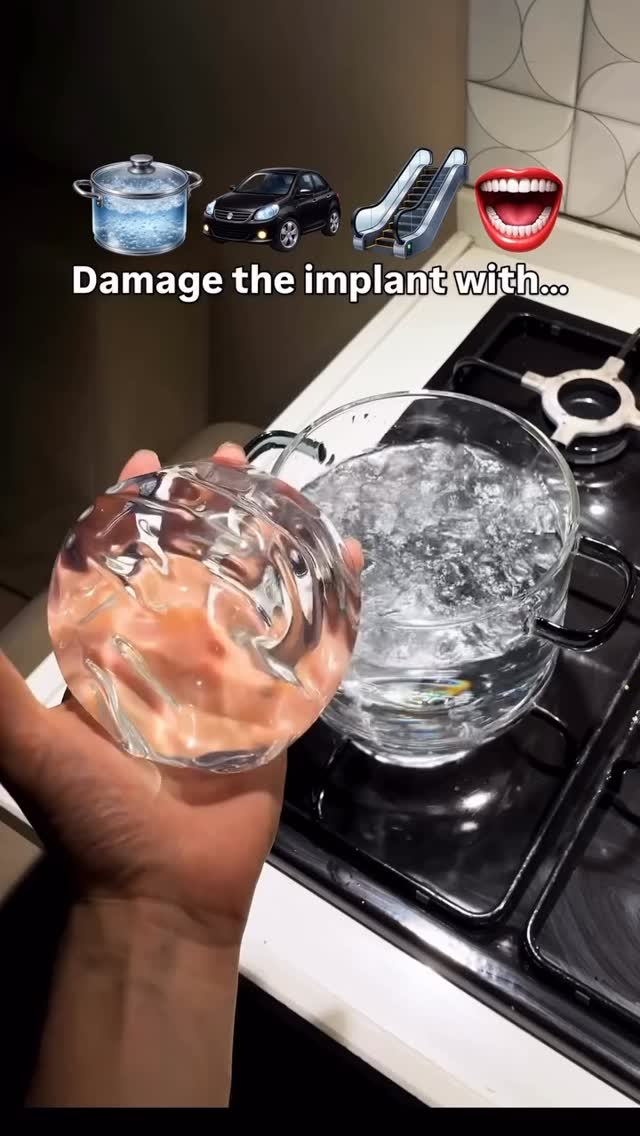 Let see how good the material implants #medicaltourism #plasticsurgery #fatremoval #lipo #cosmeticsurgery