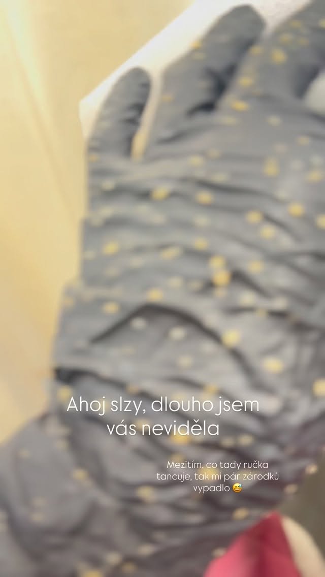 Extrakce, moje antidepresivum 🩵🙏
#akne #cistaplet #cistenipleti