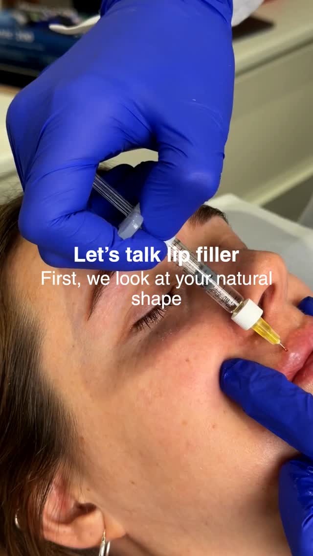 A lot of people think lip filler is just… injecting and done.
But it’s actually a process.
We start by really looking at your lips.
Your shape, your proportions, how everything sits with your face.
Then we build slowly.
Small amounts, placed carefully, step by step.
There’s no rushing, no overfilling, no guessing.
#skincareplan #skinconsultation #skincarehelp #personalisedskincare #skineducation #aestheticclinic