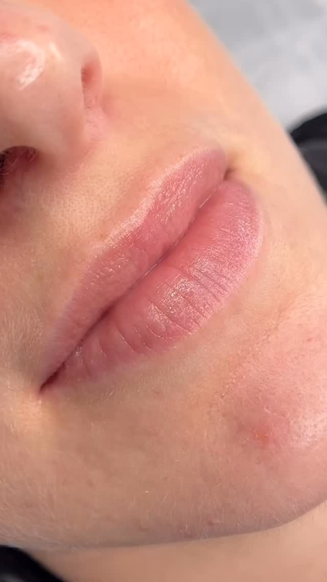 Repare na transição desse vídeo. Não é apenas sobre cor; é sobre revitalização. Lábios pálidos ou sem contorno muitas vezes nos dão um aspecto de cansaço que nem o corretivo resolve.
O resultado? Um rosto mais iluminado e um sorriso que atrai olhares.
✅ Naturalidade.
✅ Segurança.
✅ Durabilidade.
Pronta para transformar seu sorriso?
#micropigmentaçãolabial #uberlandiamg #sobrancelhafioafio