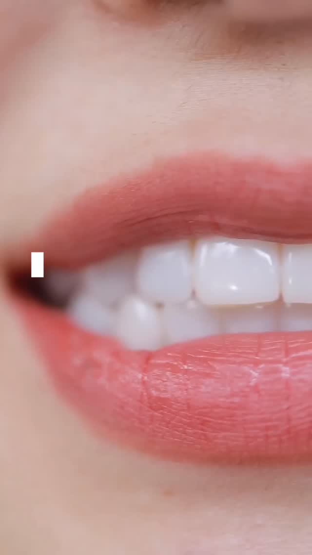 🦷 Bien se brosser les dents, ça s’apprend !
Pas de souci particulier ?
👉 Un dentifrice fluoré classique suffit largement.
⏱️ 2 fois par jour (matin et soir)
⏳ 2 minutes minimum à chaque brossage
Voici les mouvements à effectuer :
- Intérieur → mouvements circulaires et/ou verticaux
- Extérieur → mouvements circulaires et/ou verticaux
- Faces occlusales → mouvements horizontaux
⚠️ Ne brosse pas trop fort (tu abîmeras tes gencives) et surtout n’oublie pas la langue !
👉 Ce n’est pas la force, c’est la technique qui fait la différence.
✨ Un bon brossage = une meilleure santé bucco-dentaire
Une question ? Besoin d’aide ? Contactez nous !
📍 Luxembourg | 📞 +352 26 74 57 80
#roddeassocies #CabinetDentaire #SantéDentaire #SchifflangeLuxembourg #dentisteluxembourg