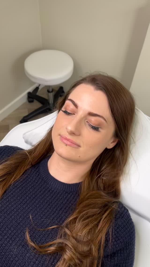 Lip enhancement focused on the mid-section of both the upper and lower lip is all about refining structure and balance rather than adding excessive volume.
This technique enhances the central body of the lips often referred to as the “pout zone” to create a softer, fuller appearance while maintaining a natural shape. By carefully placing product through the midline, we can improve definition, support the lip structure, and enhance projection without overfilling the borders.
The result is a more balanced, hydrated look with subtle volume where it matters most
𝐂𝐞𝐓𝐞 𝐀𝐞𝐬𝐭𝐡𝐞𝐭𝐢𝐜𝐬
👩🏽⚕️ 𝐑𝐞𝐠𝐢𝐬𝐭𝐞𝐫𝐞𝐝 𝐧𝐮𝐫𝐬𝐞
📧 𝐜𝐡𝐥𝐨𝐞@𝐜𝐞𝐭𝐞𝐚𝐞𝐬𝐭𝐡𝐞𝐭𝐢𝐜𝐬.𝐜𝐨.𝐮𝐤
📲 𝐰𝐰𝐰.𝐜𝐞𝐭𝐞𝐚𝐞𝐬𝐭𝐡𝐞𝐭𝐢𝐜𝐬.𝐜𝐨.𝐮𝐤
📍 𝟐𝟕𝟖 𝐀𝐬𝐡𝐛𝐲 𝐇𝐢𝐠𝐡 𝐒𝐭𝐫𝐞𝐞𝐭, 𝐃𝐍𝟏𝟔 𝟐𝐑𝐗, 𝐒𝐜𝐮𝐧𝐭𝐡𝐨𝐫𝐩𝐞
For an appointment: Please send a DM or you can book directly via the link below ⬇️
www.ceteaesthetics.co.uk
——
#scunthorpeaesthetics #dermalfiller #lincolnshireaesthetics #aesthetics #scunthorpebusiness