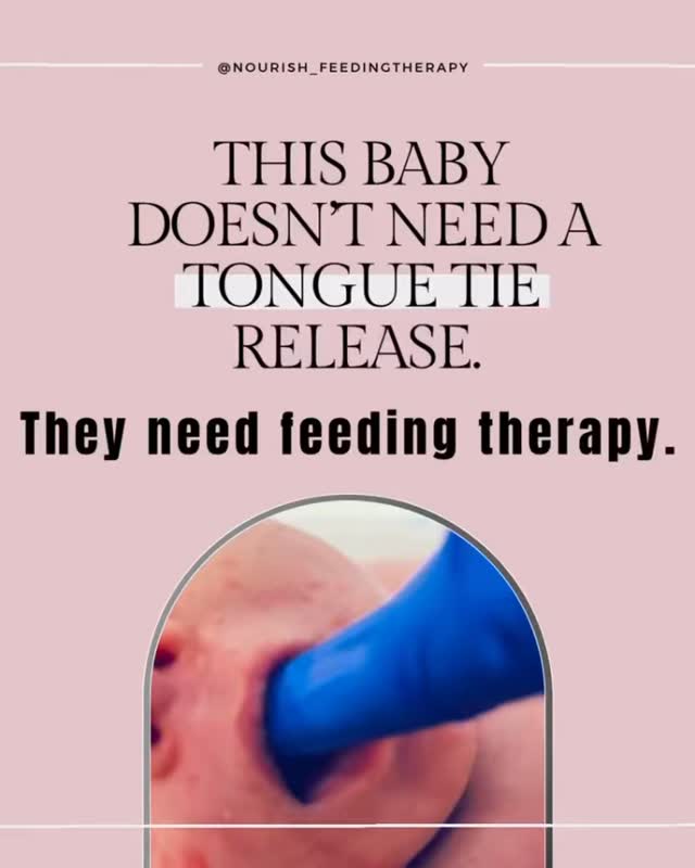 😛 Tongue tie release changes STRUCTURE.
😛 Feeding Therapy changes FUNCTION.
When babies have a tongue tie, function is always part of the problem. Infants benefit from a functional feeding evaluation with a specialists trained in tethered oral tissues, IBCLC/SLP/OT
Things that should improve before a tongue tie release, with the right team:
👅 Latch comfort
👅 Tongue cupping and extension
👅 Tongue wave, rather than chomping
👅 Improved lip/cheek seal for better suction and transfer
👅 Suck-swallow-breathe coordination
👅 Improved endurance
👅 Body symmetry and strength to support feeding
👅Tension throughout the body, including neck, shoulders, and mouth
👅 Nervous system and sensory processing- because this heavily influences feeding
Function first. THEN a release.
Feeding struggles? Nourish Therapy specializes in infant feeding, lactation, and tethered oral tissues. Schedule a discovery call to get started. I would love to help you meet your feeding goals.