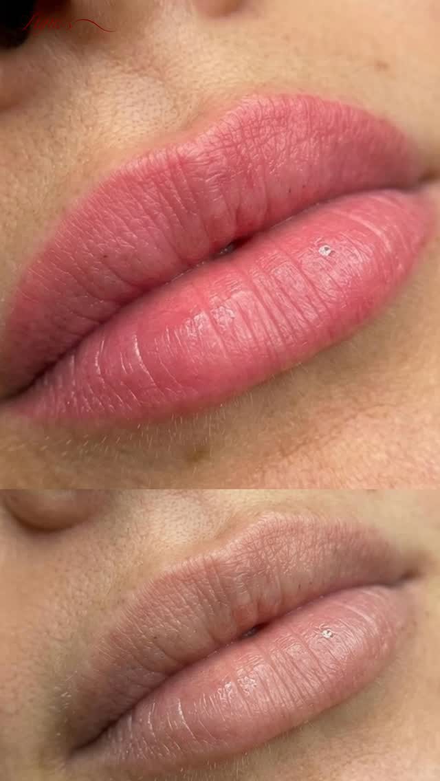 She didn’t need a bigger change.
She just needed her lips to stop looking pale. 😮💨💋
Top: after Velvet Aquarelle Lips ✨
Bottom: before — when the lips looked lighter, flatter, and a little washed out.
And this is exactly why so many women feel like they “need lipstick” all the time.
Not because they want a full glam look…
but because pale lips can make your whole face look less alive. 🪞
What changed here:
a soft, healthy-looking pink tone 🌸
more even colour from corner to corner
a fresher, more polished look without looking “done” 🤍
that your lips but better effect
This is for the girl who wants to wake up, throw on sunscreen, grab a coffee, and still look put together. ☕️✨
If you keep thinking,
“I look washed out without lip colour,”
this is your sign.
DM me “LIPS” + tell me your goal: super natural or more defined and I’ll guide you. 💌
📍Luna Beauty Studio — inside The Clinica, Richmond Hill (GTA)
#VelvetAquarelleLips #LipPMU #NaturalLipTattoo #SoftLipTattoo #YourLipsButBetter PaleLips
