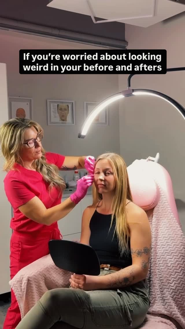The things we do for a good angle 📸😂
If you’ve ever wondered what’s happening behind the camera… it’s this.
————————
Smooth Secret RN 💋 It’s our Secret
Jo-Lynn Gibbs RN, BScN
#BeforeandAfter #MedicalAesthetics #NurseInjector