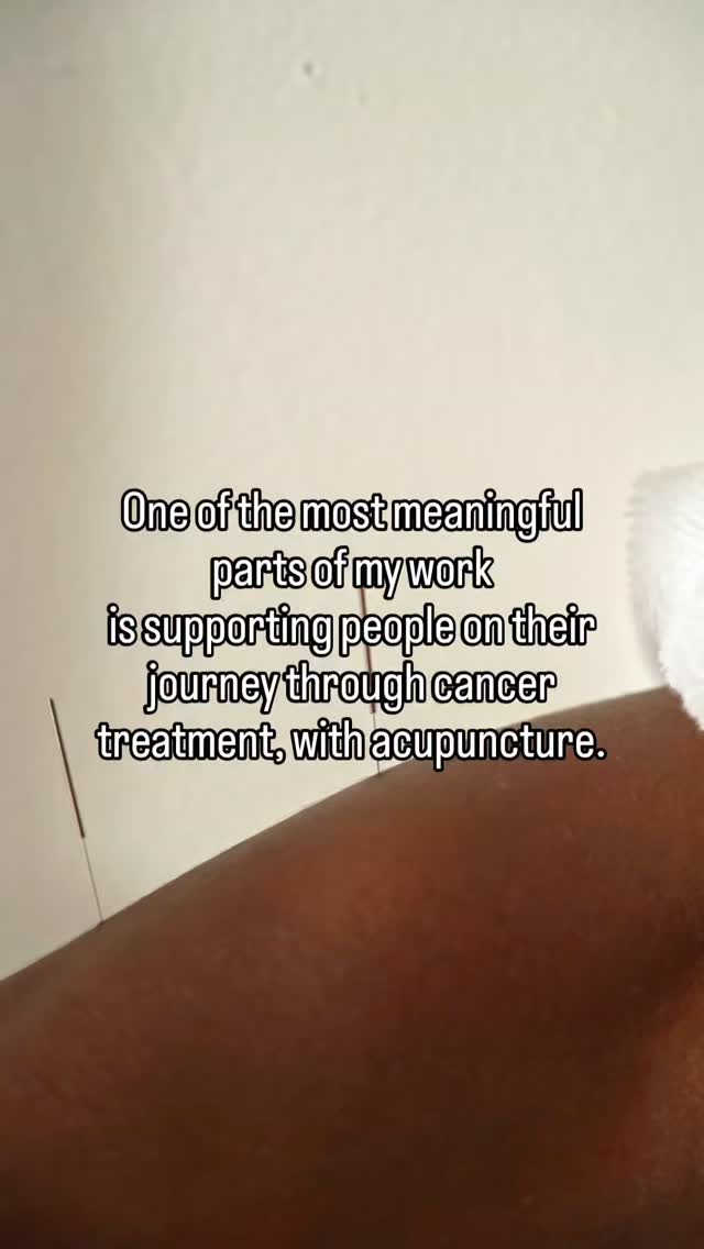 Cancer treatment can be life-saving but it can also be incredibly hard on the body.
Many people going through chemotherapy, radiotherapy or recovery experience symptoms such as fatigue, nausea, neuropathy, brain fog, poor sleep and emotional overwhelm.
Acupuncture is increasingly used as a supportive therapy alongside conventional cancer care to help manage some of these side effects and support overall wellbeing.
Research shows acupuncture may help with:
• chemotherapy-related nausea
• cancer-related fatigue
• peripheral neuropathy
• sleep and anxiety
• general quality of life during treatment
But beyond the research, something else happens in the treatment room.
Patients often describe feeling their body soften… their nervous system settle… and finding a moment of calm in the middle of a very challenging time.
It’s not about replacing medical treatment.
It’s about supporting the body while it goes through it.
If you or someone you love is going through cancer treatment, always speak with your oncology team before starting supportive therapies.
Gentle support when the body needs it most.
#acupuncture #integrativemedicine #cancersupport #chemotherapysupport #acupunctureworks wellbeingcare supportivecare holistichealth