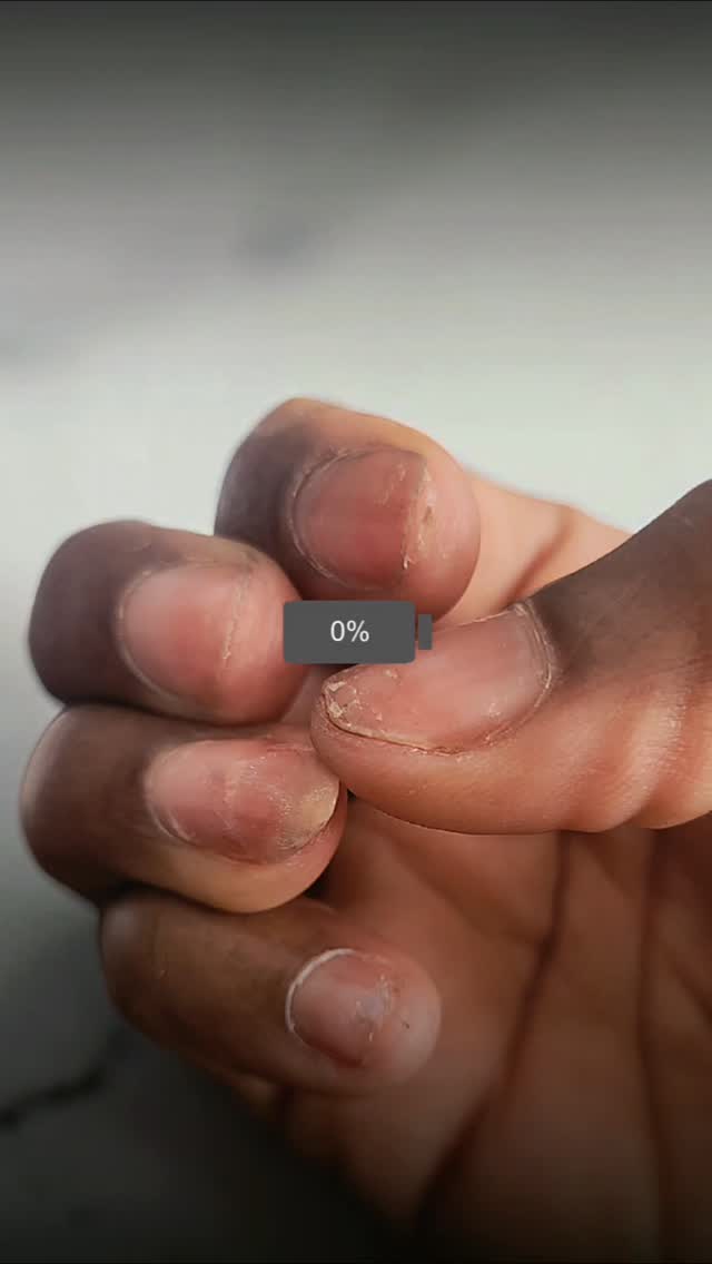 A gentle restoration, a fresh start… and the journey to healthy and beautiful nails 💅🌟🪄
#alliston
#nailjourney
#bluenails
#nails
#gelnails