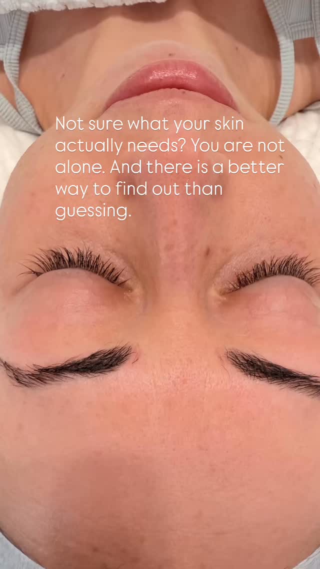 So many of the women I see have been doing their best - buying good products, following advice, trying treatments but without anyone ever properly looking at their skin first. 👀
That is what our $99 New Client Skin Experience is for.
It is not just a facial. It is a proper starting point.✨
Here is what happens when you come in:👇
✅ We sit down and talk about your skin your history, your concerns, what you have tried, what ou want.
✅ I do a thorough skin analysis. Not a quick glance a real assessment of what is actually going on beneath the surface.
✅ Then I perform a customised treatment on the day, chosen specifically for your skin right now.
✅ And before you leave, we map out a results-focused skin plan together - so you know exactly what your skin needs and why.
The appointment is 60-75 minutes. It is $99 for new clients.
If you have been putting off getting proper help for your skin, this is the place to start. ✨
Comment AGE below and I will send you the booking link directly to your DMs. 💕
#newclients #skinexperience #skinclinic #tweedheads #antiaging