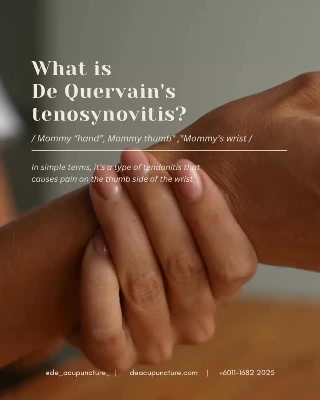 🤯 What is De Quervain’s Tenosynovitis? (A.K.A. “Mommy Wrist”) 🤱
De Quervain’s Tenosynovitis is a common and often very painful condition that affects the tendons on the thumb-side of your wrist.
The Problem:
In De Quervain’s, the problem is not the tendon itself, but the sheath surrounding two specific tendons that go to your thumb (the abductor pollicis longus and the extensor pollicis brevis).
Repetitive motions cause this tendon sheath to become:
🔺Irritated and Inflamed
🔺Thickened and Swollen
This pain is typically worse when you:
👉🏻Turn your wrist (like turning a key)
👉🏻Grasp or grip anything forcefully (like opening a jar)
👉🏻Pinch objects (like holding a phone or a baby)
👉🏻Make a fist
👉🏻Swelling or tenderness at the base of the thumb.
👉🏻A “sticking” or “snapping” sensation when you move your thumb.
👉🏻Pain that may radiate up your forearm.
🌿 How TCM Can Help?
❇️Acupuncture
❇️Moxibustion
If you are struggling with “Mommy Wrist” or any kind of persistent wrist pain, consider a holistic approach.
Ready for pain relief?
Book an appointment with our qualified TCM physicians at 医心医意中医坊 De Acupuncture x Herbs Centre to get a personalised treatment plan for your condition! 💖
#DeQuervainsTenosynovitis #MommyWrist #WristPain #TCMforPain #Acupuncture #TuiNa #TCMTreatment #SubangJayaTCM #HandPain #RepetitiveStrainInjury