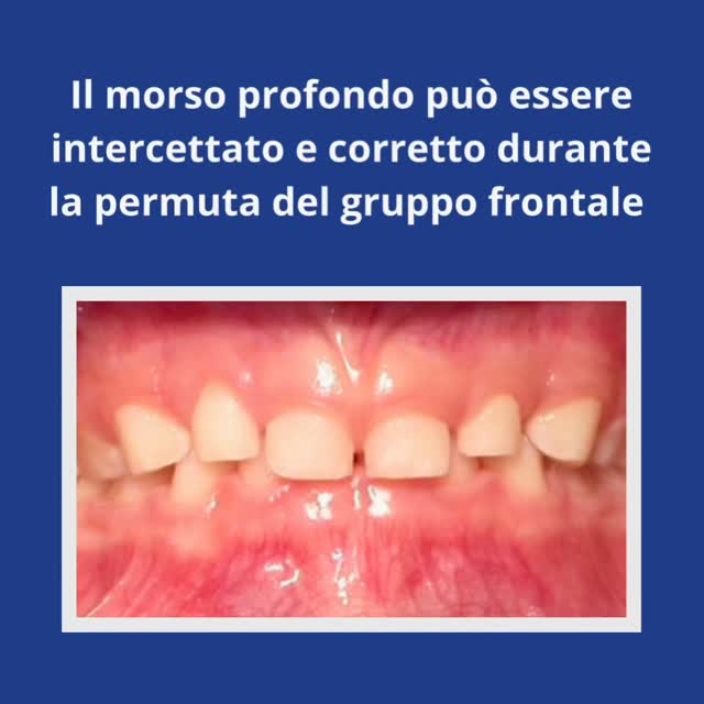 Corso Formativo Verona, 17-18 aprile 2026
Per iscrizioni scrivi a: info@orthopiu.it
#ortodonzia #miofuncional #intercettiva