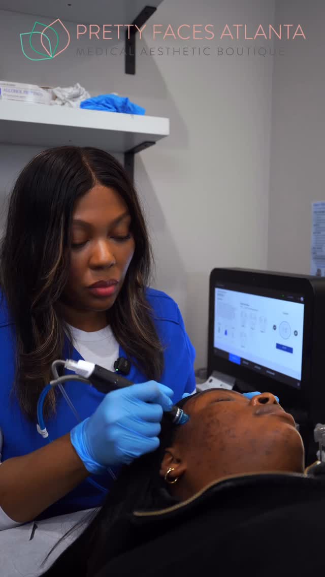 HydraLase is the glow your skin has been missing ✨
Deep cleanse + advanced laser = real results, not just surface level
💧 Unclogs pores & removes buildup
✨ Targets acne + breakouts
🎯 Fades dark spots & hyperpigmentation
🔥 Reduces redness & inflammation
💎 Smooths texture & boosts overall glow
This combo works UNDER the skin to actually fix the problem, not just treat it
Right now you can SAVE $300 on HydraLase 🧖🏽♀️
If your skin has been dull, breaking out, or uneven… this is your reset
Book now at PrettyFacesAtlanta.com
Results speak for themselves 💯
#HydraLase #PrettyFacesAtlanta #AtlantaMedSpa #ClearSkinJourney #SkinGlow