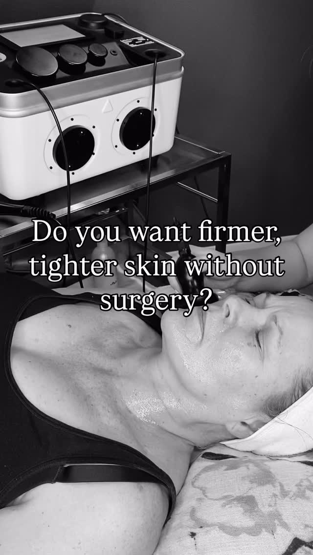 Collagen Lift
Non-surgical Radio Frequency skin tightening for face & body.
This treatment works deep within the skin to stimulate collagen production, helping to firm, lift and smooth.
💫 Benefits:
• Tightens and firms skin
• Improves tone & texture
• Softens fine lines
• Helps reduce cellulite appearance
• Relaxing, non-invasive treatment
Best results with a course of 6–8 sessions.