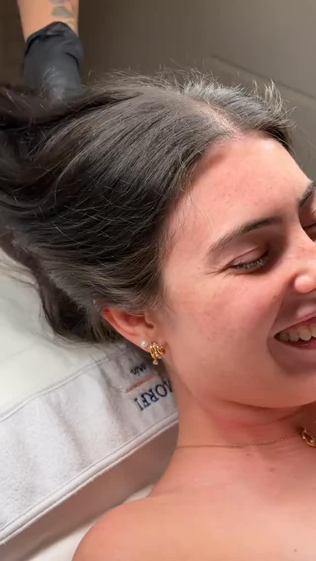 ✨ Microneedling: Your Skin’s Natural Glow-Up ✨
Looking for a treatment that helps your skin look smoother, firmer, and more radiant? Microneedling might be exactly what you need! 💆♀️
🔍 What is Microneedling?
Microneedling is a minimally invasive skin treatment that uses tiny, sterile needles to create micro-injuries in the skin. This process stimulates your body’s natural healing response, boosting collagen and elastin production.
💡 Benefits:
✔️ Improves skin texture and tone
✔️ Reduces fine lines and wrinkles
✔️ Minimizes acne scars and pores
✔️ Enhances product absorption
✔️ Gives your skin a natural, healthy glow
⏳ What to expect?
After the treatment, your skin may appear slightly red (like a mild sunburn) for 24–48 hours. Over the next few days, your skin will start to feel smoother and look more refreshed.
💖 Best results?
A series of sessions is recommended for optimal, long-lasting results. Your skin will thank you!
📩 Ready to transform your skin? Book your appointment today!
#Microneedling #SkinCare #GlowSkin #CollagenBoost #BeautyTreatment
:::