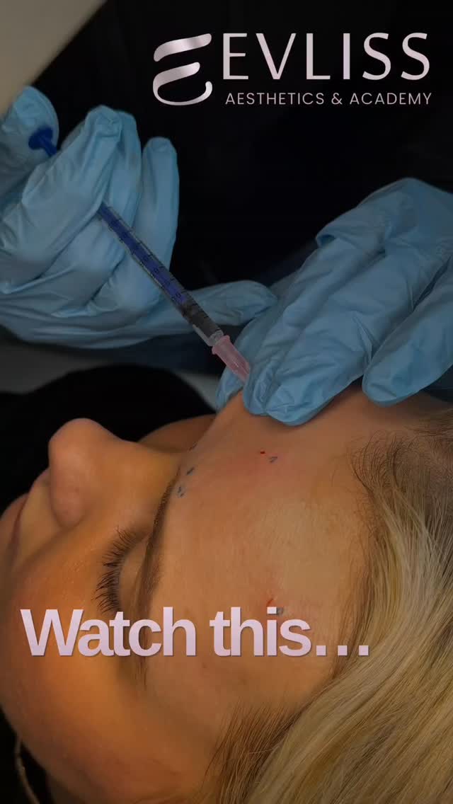This level of control takes time.
Not just practice —
but understanding, correction, and repetition.
What looks simple…
is built slowly.
📩 Message if you want to learn properly
📲 07526 072 246
🌐 evliss-academy.co.uk
📍 London & Watford
#aestheticsacademyuk #aesthetictraininglondon #aestheticcareer #aestheticsindustry