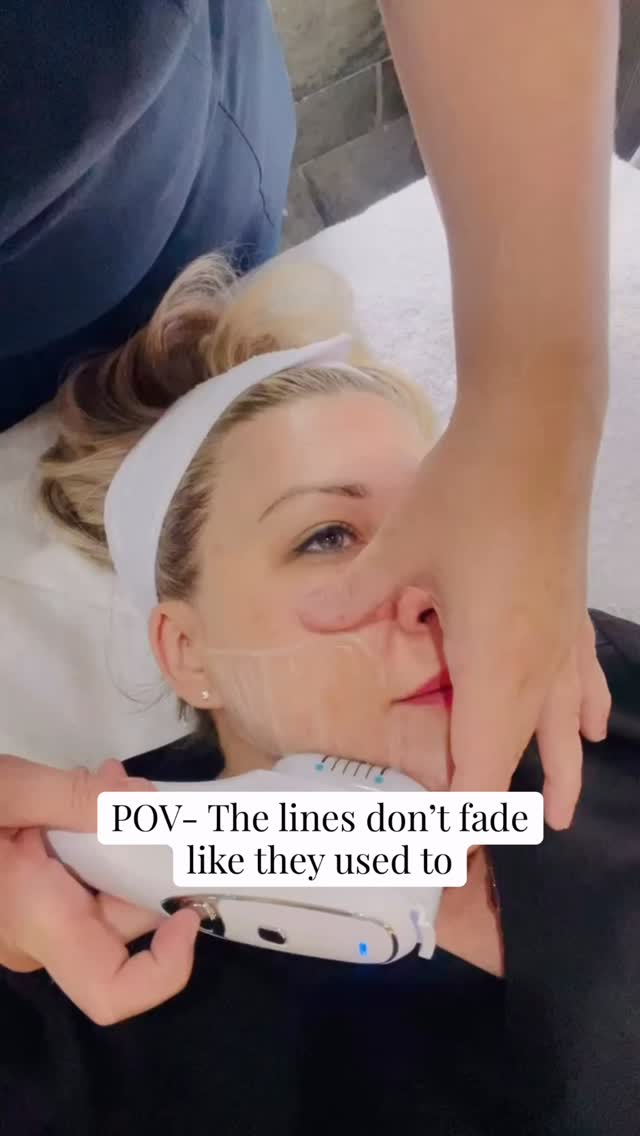 Lines used to disappear.
Now they stay longer.
That’s when people start to notice.
This is where prevention becomes correction. Using multi modalities to transform your appearance.
📩 DM “FACE”
📧 hello@lifestyleyou.co.uk
📱 WhatsApp: 07843 841144
#wrinkles #facialageing #aestheticclinicuk #skinconfidence #antiageing