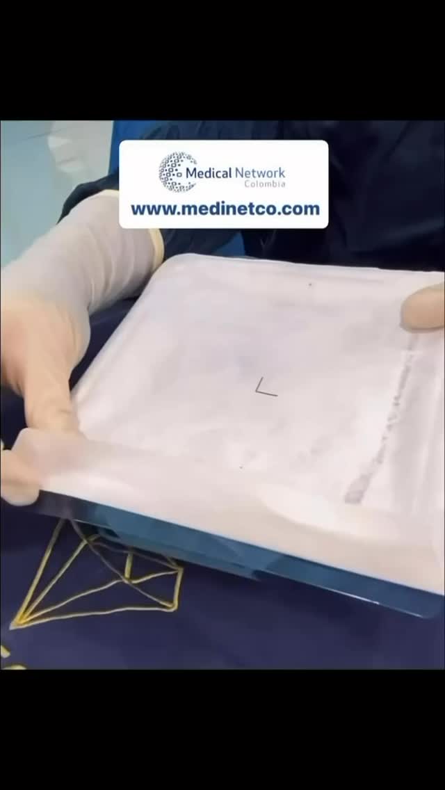 Bogotá, Colombie 🇨🇴
Avec mes partenaires Medinetco ✨
Ici, on ne fait pas juste parler de prix…
On parle de sécurité, d’accompagnement et de standards élevés.
Chaque détail est pensé.
Chaque étape est encadrée.
Parce que votre transformation mérite
bien plus qu’un bon prix : elle mérite la tranquillité d’esprit. 💛
Écris-moi pour en savoir plus sur Messenger
#chirurgieesthetiqueinternational #medicaltourismcolombia #PlasticSurgeryColombia #DentalTourism #viprecoveryexperience
@recoveryhomecolombia @medinetco