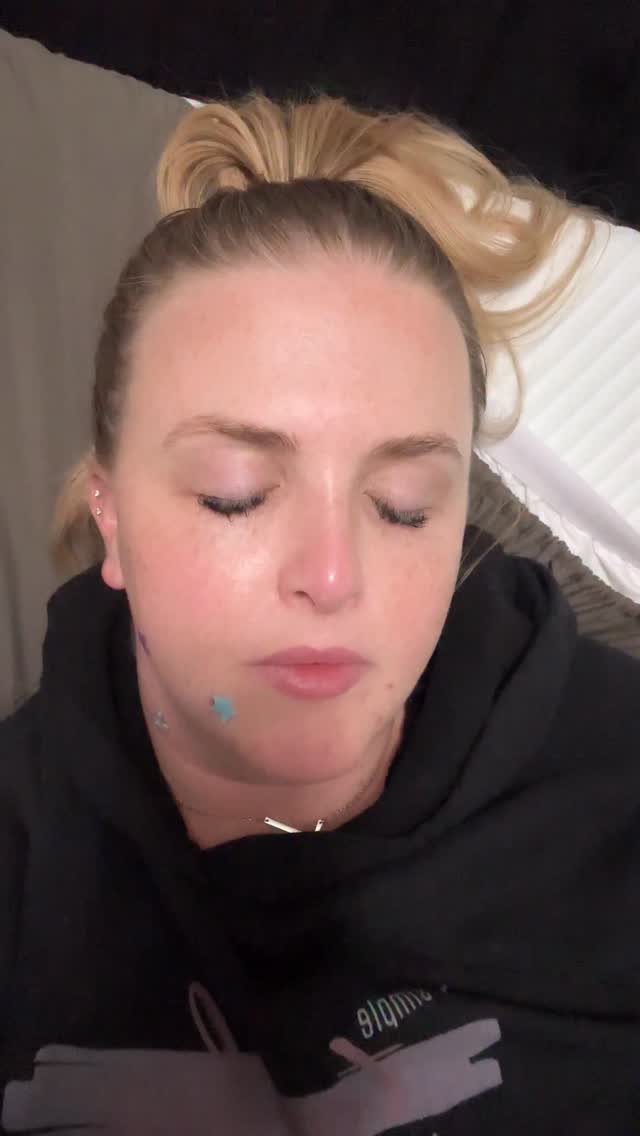 Holy histamine 🫠😭😱 Autoimmune diseases are not for the weak 🙅🏼♀️🙅🏼♀️🙅🏼♀️