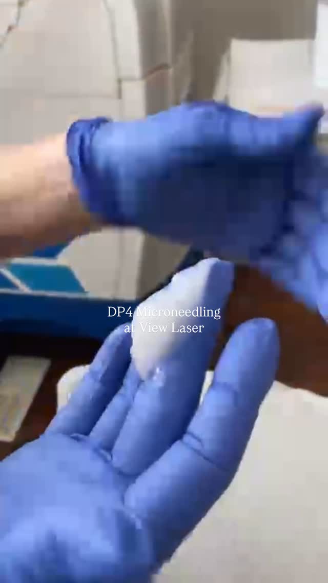 Glow, but make it next level ✨
Meet DP4 Microneedling, our go-to for smoother texture, refined pores, and that lit-from-within skin. Tiny microchannels + your skin’s natural healing = serious collagen stimulation and real results.
Want to elevate it?
Add a booster like VAMP or NCTF for an extra dose of skin-loving nutrients, or finish with a luxe sheet masque from ZO Skin Health to calm, hydrate, and lock in that post-treatment glow.
Customizable. Results-driven. Worth it.
Book now at viewlaser.com