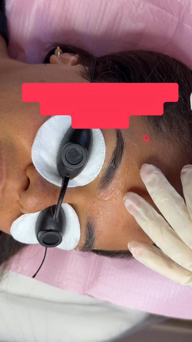 ⭕️Models Wanted for Brow Tattoo Removal ⭕️
💁♀️if you have tattooed brows are dark, wrong shape or fade to Red, Orange, yellow..,
Send me your Brow Photos to get selected
⏰ Date: 8 May, 12pm,1pm,2pm,3pm
💸 Cost $50
🏡 Level 5, 76 Manners street, Wellington
☎️ Call or Text 0212321788